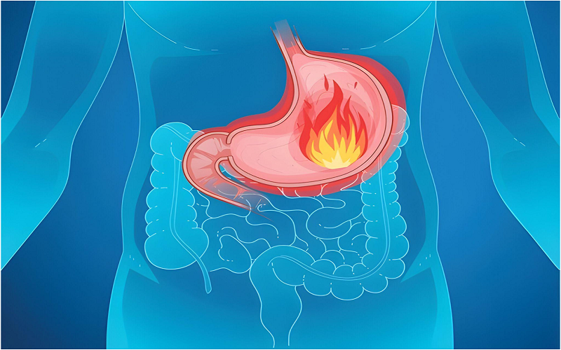 Symptoms of Gastritis